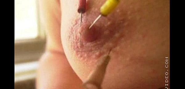  needles in my tit